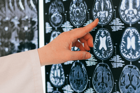 Finger pointing to brain MRI scans